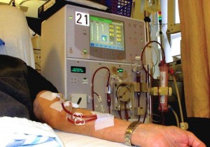 dialysis